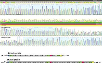 Case Report: A novel PHOX2B p.Ala248_Ala266dup variant causing congenital central hypoventilation syndrome